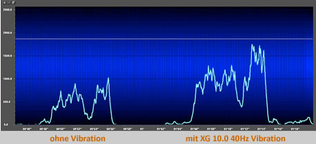EMG mit XG 10.0 - eine Verdoppelung